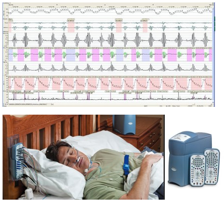 Diagnosis of Obstructive Sleep Apnoea