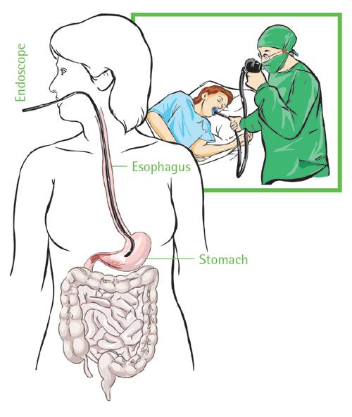 Gastroscopy