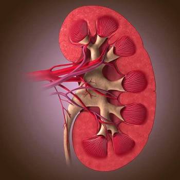 Renal Cancer