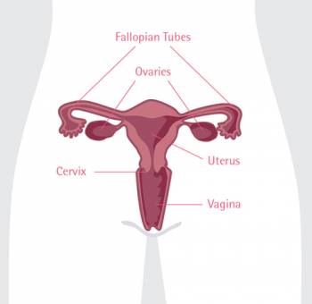 ovarian cancer