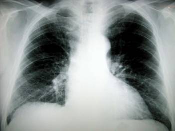 Respiratory Physicians